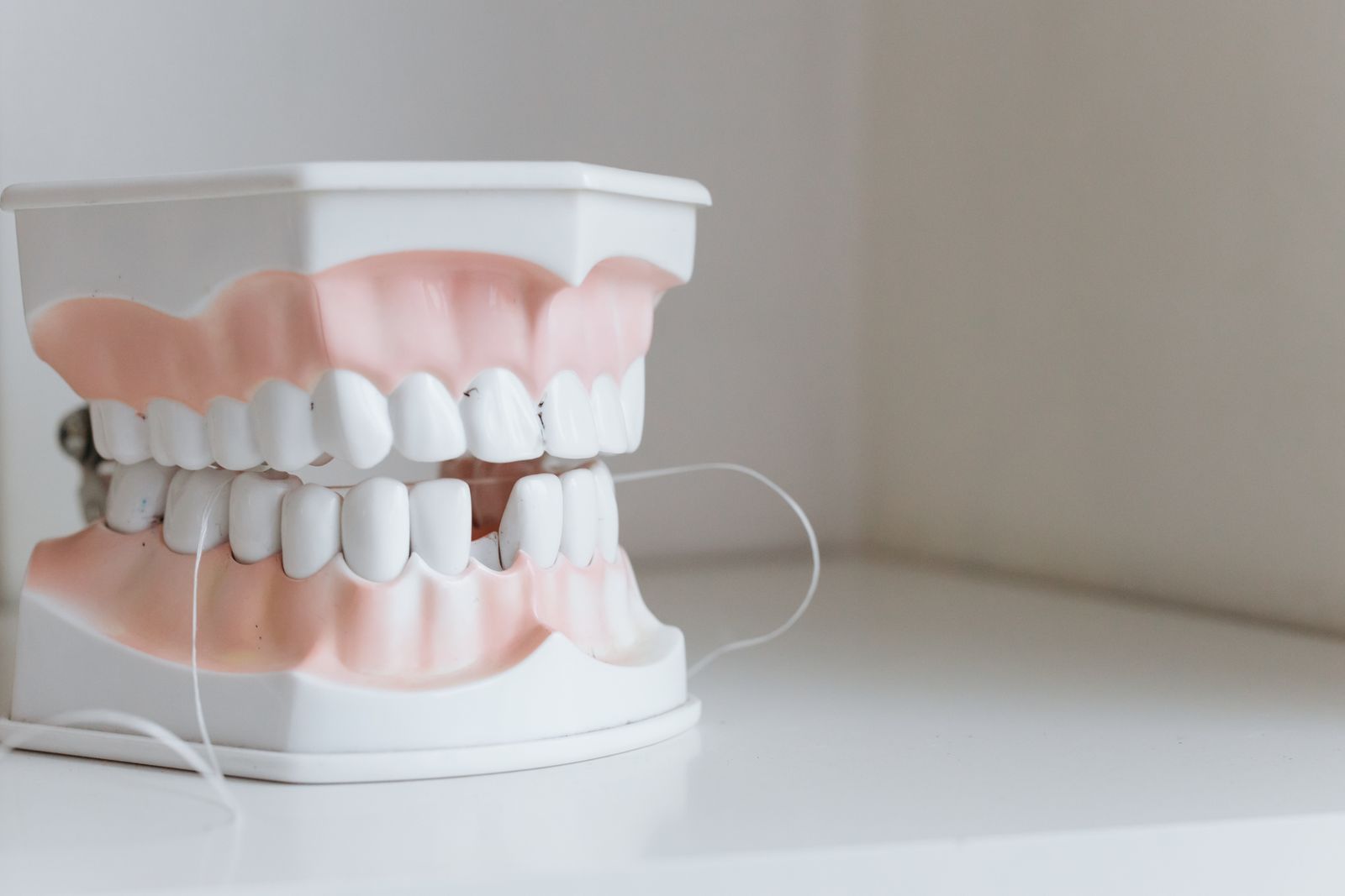 Dinți pătați sau decolorați? Primii pași spre un zâmbet îngrijit, la Upgrade Dental